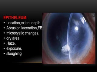 EPITHELEUM:
• Location,extent,depth
• Abrasion,laceration,FB
• microcystic changes,
• dry area
• Haze,
• exposure,
• sloughing
 