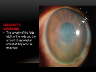 DESCEMET’S
MEMBRANE
• The severity of the folds-
width of the folds and the
amount of endothelial
area that they obscure
from view.
 