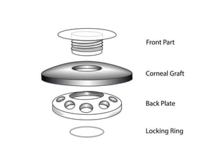 Eye banking and keratoplasty