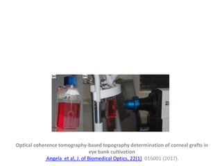 Optical coherence tomography-based topography determination of corneal grafts in
eye bank cultivation
Angela et al, J. of Biomedical Optics, 22(1), 016001 (2017).
 