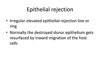 Epithelial rejection
• Irregular elevated epithelial rejection line or
ring
• Normally the destroyed donor epithelium gets
resurfaced by inward migration of the host
cells
 