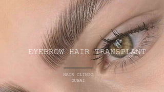 EYEBROW HAIR TRANSPLANT
HAIR CLINIC
DUBAI
 