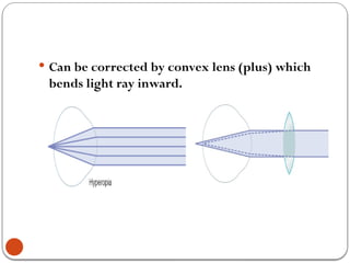 Light Rays Inwaerd Eye disorder- Medical surgical Nursing.pptx