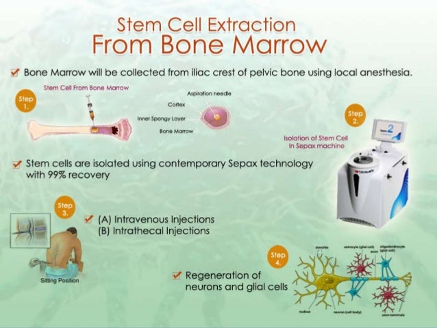 marrow how extract bone disorders ppt Eye