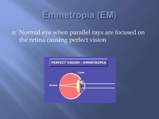  Normal eye when parallel rays are focused on
the retina causing perfect vision