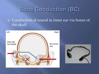  Conduction of sound in inner ear via bones of
the skull