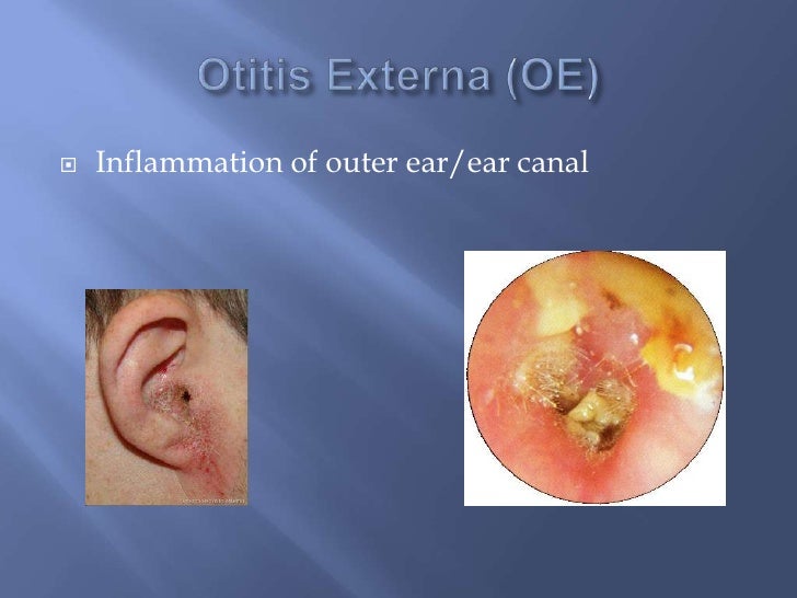 Eye & ear abbreviations