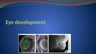 eye_embryology.pptx /eye development/neuroanatomy | PPTX