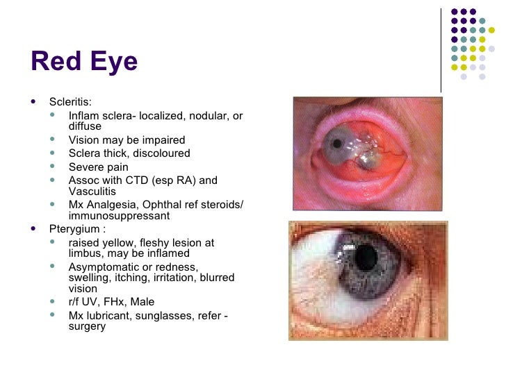 Eye Emergencies eye-emergencies