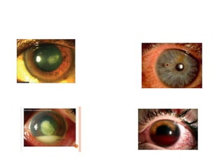 Eye emergencies | PPTX