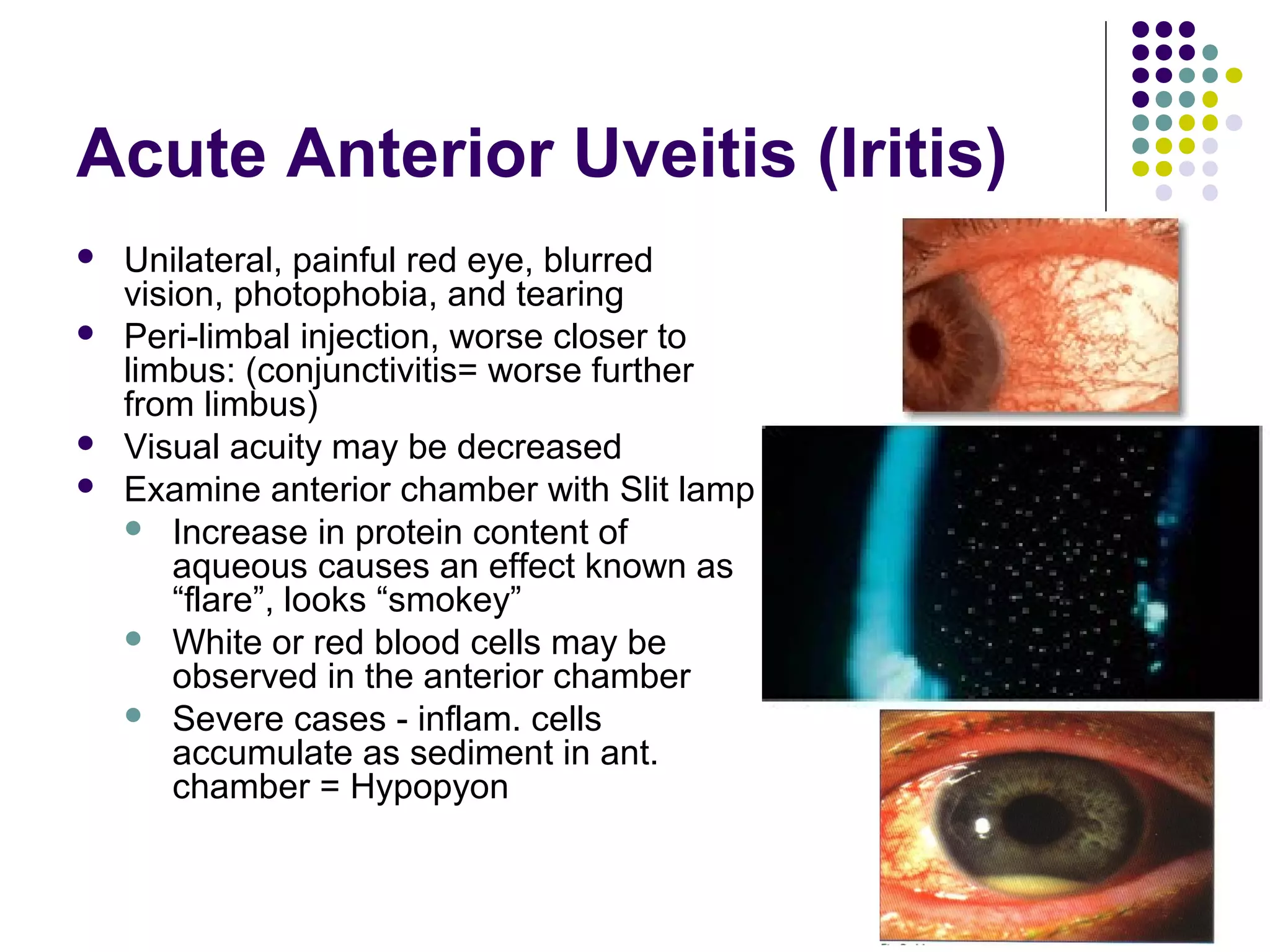 Eye emergencies emc | PPT | Eye and Vision Conditions | Diseases and ...