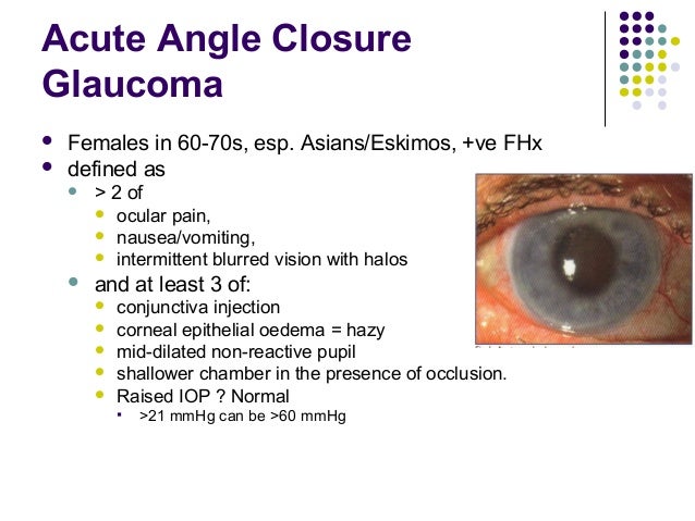 Glaucoma Surgery Series Trabeculectomy