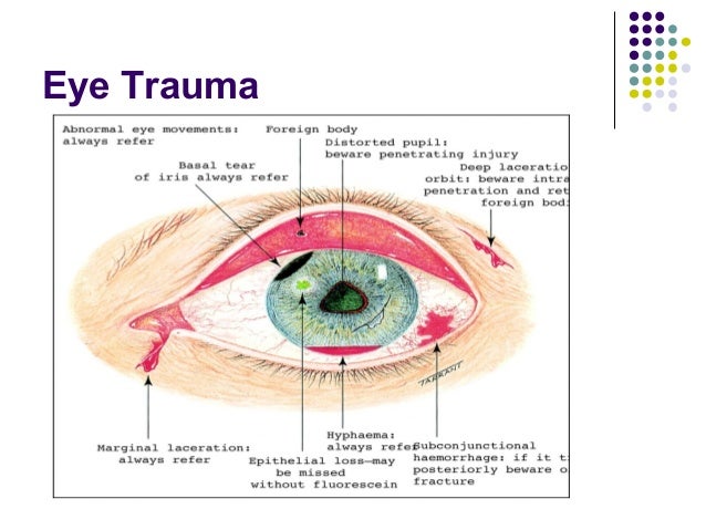 Eye emergencies emc