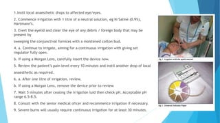 1.Instil local anaesthetic drops to affected eye/eyes.
2. Commence irrigation with 1 litre of a neutral solution, eg N/Saline (0.9%),
Hartmann’s.
3. Evert the eyelid and clear the eye of any debris / foreign body that may be
present by
sweeping the conjunctival fornices with a moistened cotton bud.
4. a. Continue to irrigate, aiming for a continuous irrigation with giving set
regulator fully open.
b. If using a Morgan Lens, carefully insert the device now.
5. Review the patient’s pain level every 10 minutes and instil another drop of local
anaesthetic as required.
6. a. After one litre of irrigation, review.
b. If using a Morgan Lens, remove the device prior to review.
7. Wait 5 minutes after ceasing the irrigation luid then check pH. Acceptable pH
range 6.5-8.5.
8. Consult with the senior medical oficer and recommence irrigation if necessary.
9. Severe burns will usually require continuous irrigation for at least 30 minutes.
 