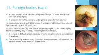 11. Foreign bodies (ears)
 Foreign bodies can be removed using microforceps / a blunt hook (under
otoscopy or syringing)
 If uncooperative child, removal under general anaesthesia is advised
-if foreign body is an insect: kill it with a few drops of 1% lignocaine or olive oil
before removing with microforceps.
-organic freign bodies (eg: pea, tissue, paper & sponge). Do not use syringing
technique as they may swell up, rendering removal difficult.
 If removal is difficult under otoscopy, refer to ent clinic where a microscope
is available.
 One attempt by an emergency dept staff is recommended, falling which the
patient should be referred to the ent clinic.
 
