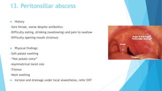 13. Peritonsillar abscess
 History
–Sore throat, worse despite antiboitics
–Difficulty eating, drinking (swallowing) and pain to swallow
–Difficulty opening mouth (trismus)
 Physical findings:
–Soft palate swelling
–“Hot potato voice”
–Asymmetrical tonsil size
–Trismus
–Neck swelling
 Incision and drainage under local anaesthesia, refer ENT
 