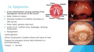 14. Epiglottitis
 Acute inflammation causing swelling of the
Supraglottic structures of the larynx
 Older children & adults
 decrease incidence in children secondary to
HIB vaccine
 Onset rapid, patients look toxic
 prefer to sit, muffled voice, dysphagia, drooling,
restlessness
 Management:
-Avoid agitation
-Direct visualization if patient allows soft tissue of neck
-Prepare for emergent airway, best achieved in a
controlled setting
-Unasyn, +/- steroids
 