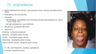 15. Angioedema
 Rapid swelling of the dermis, subcutaneous tissue, mucosa and submucosal
tissue
 Ocassionally life threatening
 Acquired
-IgE mediated: vasodilation and increased vascular permeability (ie. insect
bites, food, etc)
-not IgE mediated (ie. ace inhibitors)
 Hereditary: autosomal dominant
 Symptoms:
-Swelling + urticarial symptoms
-Aphonia - complete upper airway-
-Stridor - incomplete upper airway
-Wheezing - incomplete lower airway
-Loss of breath sounds- complete lower airway
 Tx: O2, anti-histamine, steroids, epinephrine
 Consider intubation/trach
 