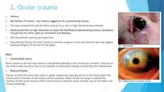 2. Ocular trauma
 History
 Mechanism of trauma – any history suggestive of a penetrating trauma.
 The type of projectile and the likely velocity (e.g. low or high) should be documented.
 Small projectiles at high velocities increase the likelihood of penetrating trauma. Symptoms
include loss of vision, pain on movement and diplopia.
 Was the patient wearing eye protection?
 Any previous history of ocular trauma or previous surgery is to be documented and may suggest
reduced integrity of the wall of the globe.
Blunt
 Closed globe injury
Blunt trauma to the eye may result in considerable damage to the intraocular contents. Fracture of
the orbital wall may occur due to the transfer of mechanical energy to relatively thin orbital bone.
 Ruptured globe
Trauma of sufficient force may result in globe rupture and typically occurs in the areas where the
scleral wall is thinnest: at the limbus (which would be visible via the slit lamp) or behind the
insertion of the rectus muscle (which would result in reduced ocular motility, loss of red reflex and
vitreous bleeding).
 