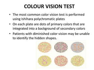 Color Vision Abnormalities EYE EXAMINATION(Linda).pptx