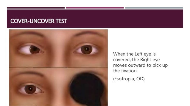 How To Do A Pediatric Eye Exam