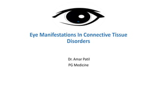 Eye Manifestations In Connective Tissue
Disorders
Dr. Amar Patil
PG Medicine
 