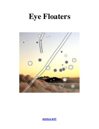 ADOLA.NET
Eye Floaters
 