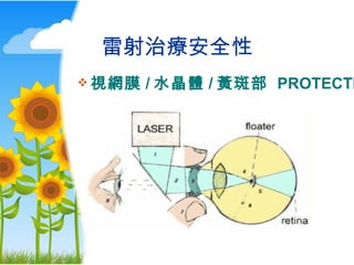 Beautiful Laser Treatment Of Eye Floaters Design Digital Art Beautiful Laser Treatment Of Eye Floaters Design Digital Art