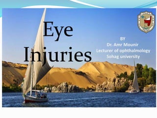Eye
Injuries
 