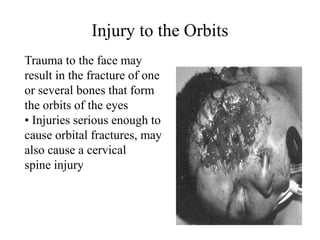Injury to the Orbits
Trauma to the face may
result in the fracture of one
or several bones that form
the orbits of the eyes
• Injuries serious enough to
cause orbital fractures, may
also cause a cervical
spine injury
 