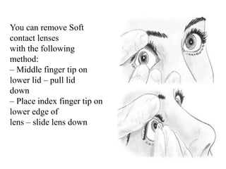 You can remove Soft
contact lenses
with the following
method:
– Middle finger tip on
lower lid – pull lid
down
– Place index finger tip on
lower edge of
lens – slide lens down
 