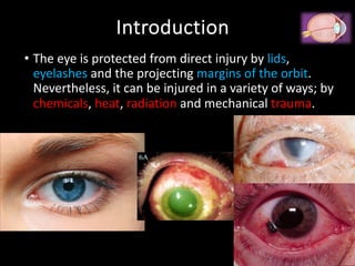 Eye injuries.pdfhhhhhhhhhhhhhhhhhhhhhhhh | PDF