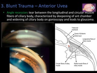 Eye injuries.pdfhhhhhhhhhhhhhhhhhhhhhhhh | PDF