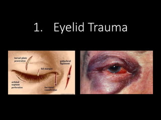 Eye injuries.pdfhhhhhhhhhhhhhhhhhhhhhhhh | PPT