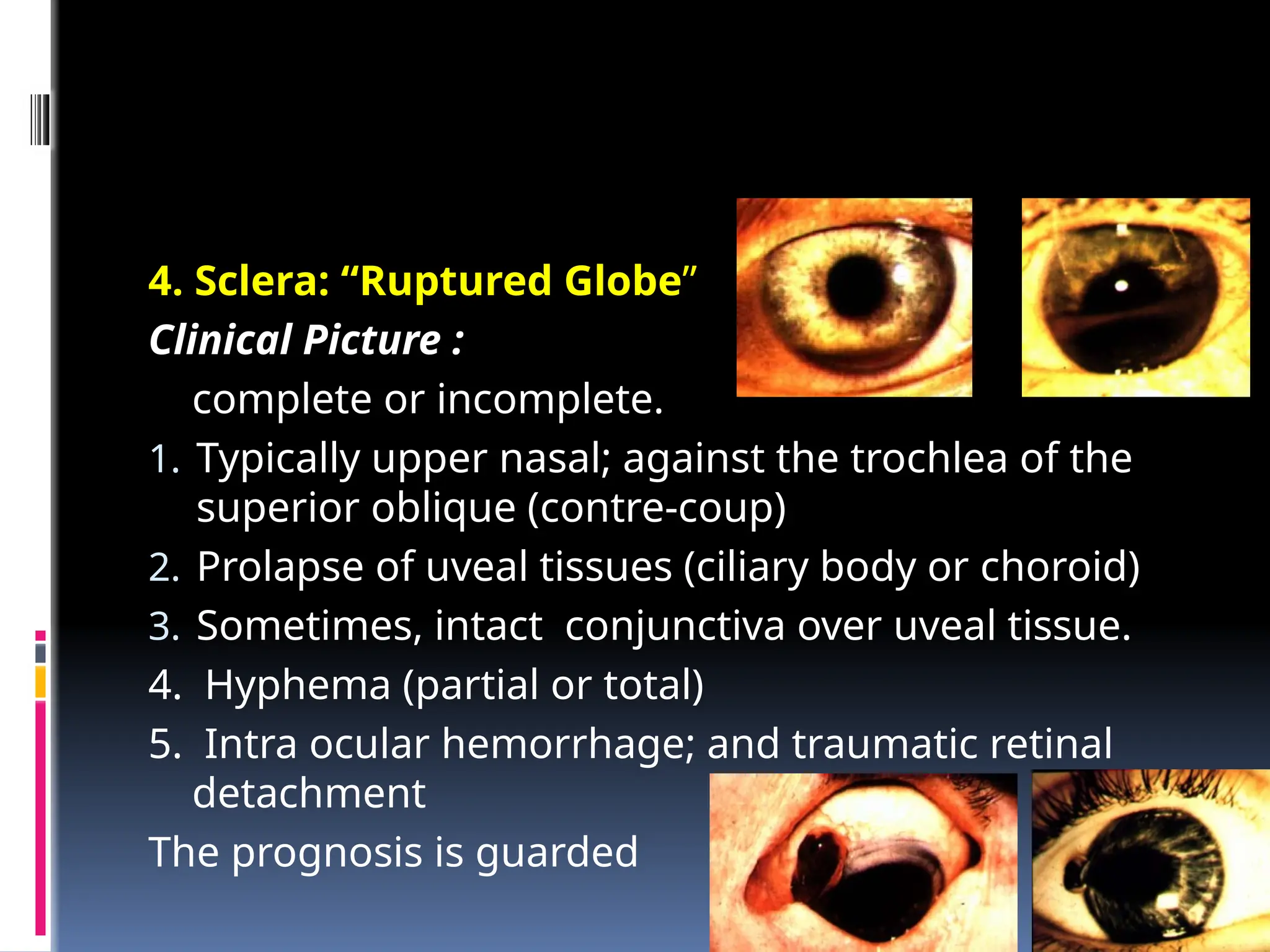 Eye Injuries6515615615616251561191956.pptx