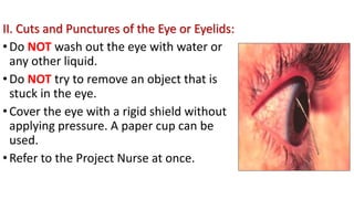 II. Cuts and Punctures of the Eye or Eyelids:
•Do NOT wash out the eye with water or
any other liquid.
•Do NOT try to remove an object that is
stuck in the eye.
•Cover the eye with a rigid shield without
applying pressure. A paper cup can be
used.
•Refer to the Project Nurse at once.
 