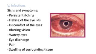 V. Infections
Signs and symptoms:
- Persistent itching
- Flaking of the eye lids
- Discomfort of the eyes
- Blurring vision
- Watery eyes
- Eye discharge
- Pain
- Swelling of surrounding tissue
 
