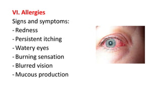 VI. Allergies
Signs and symptoms:
-Redness
-Persistent itching
-Watery eyes
-Burning sensation
-Blurred vision
-Mucous production
 