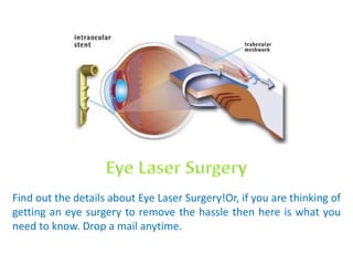 Find out the details about Eye Laser Surgery!Or, if you are thinking of
getting an eye surgery to remove the hassle then here is what you
need to know. Drop a mail anytime.
 