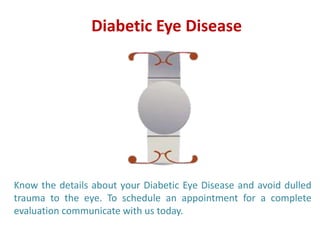 Diabetic Eye Disease
Know the details about your Diabetic Eye Disease and avoid dulled
trauma to the eye. To schedule an appointment for a complete
evaluation communicate with us today.
 