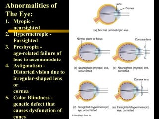 Abnormalities of
The Eye:
1. Myopic -
nearsighted
2. Hypermetropic -
Farsighted
3. Presbyopia -
age-related failure of
lens to accommodate
4. Astigmatism -
Distorted vision due to
irregular-shaped lens
or
cornea
5. Color Blindness -
genetic defect that
causes dysfunction of
cones
 