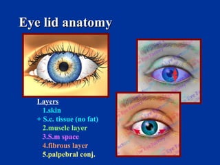Eye lid anatomy Layers 1.skin + S.c. tissue (no fat) 2.muscle layer 3.S.m space 4.fibrous layer 5.palpebral conj. 