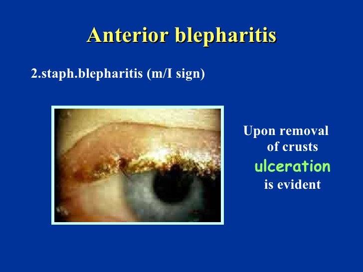 Eyelid
