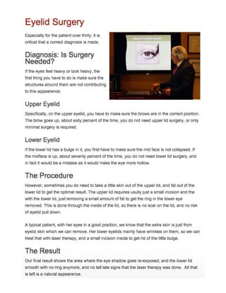 Eyelid Surgery - Dr. Mark Prysi