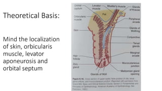 Theoretical Basis:
Mind the localization
of skin, orbicularis
muscle, levator
aponeurosis and
orbital septum
 