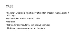 CASE
• Female 6 weeks old with history of sudden onset of swollen eyelid 4
days ago.
• No history of trauma or insects bites
• No fever
• Lid tender and red, tarsal conjunctiva chemosis
• History of warm compresses for the same
 