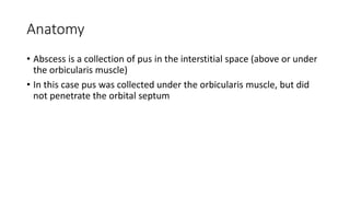 Anatomy
• Abscess is a collection of pus in the interstitial space (above or under
the orbicularis muscle)
• In this case pus was collected under the orbicularis muscle, but did
not penetrate the orbital septum
 
