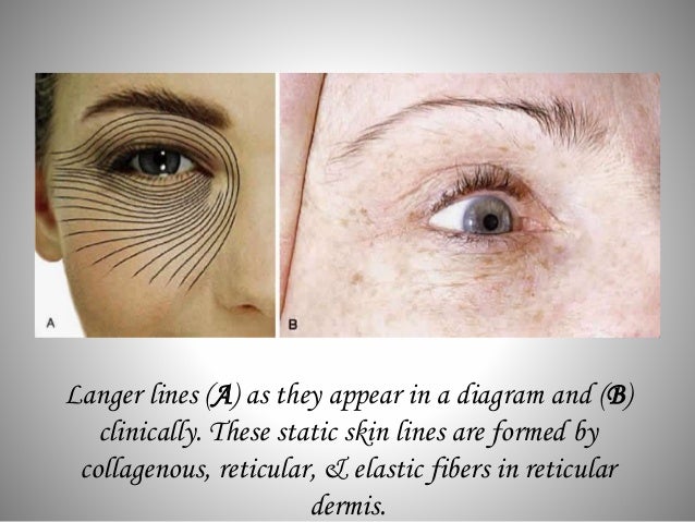 Eye lid anatomy langers lines diagram 