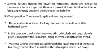 Anomalies in the position of lid margins .pptx
