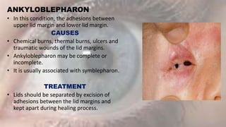 Diseases of eyelid.pptx